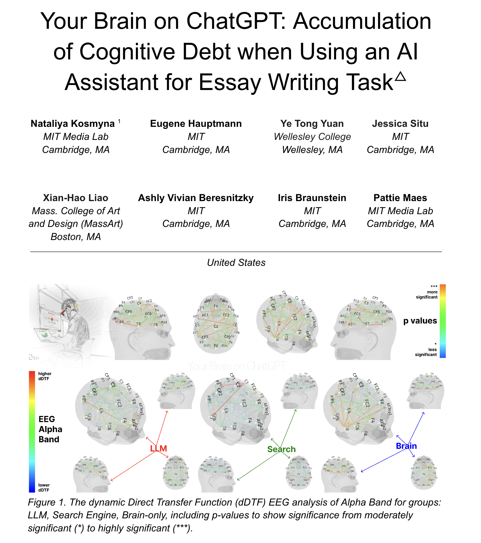 Gehirnaktivität bei KI-Nutzung